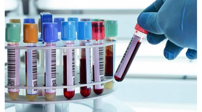 Nhầm lẫn mẫu ống nghiệm